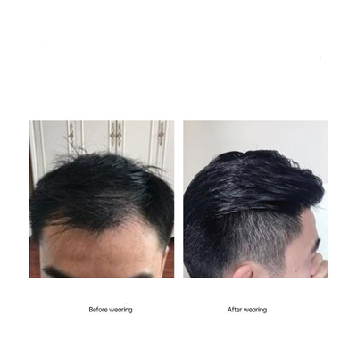 Volledig met de hand gemaakt Glijde achterste stijl haarlijn 100% menselijk haar vervanging Toupee voor mannen